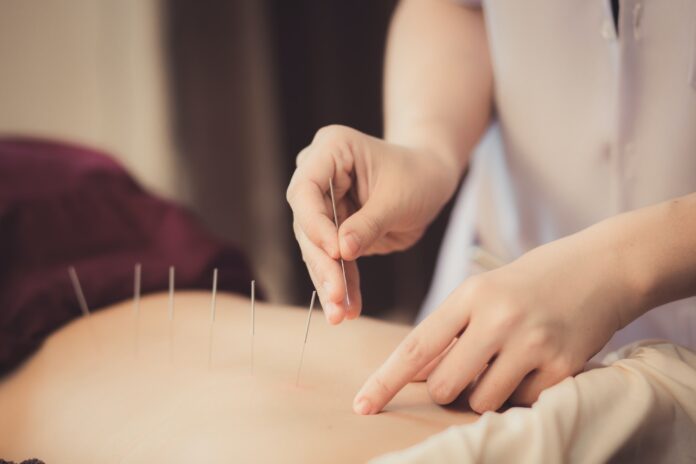 dry needling melbourne