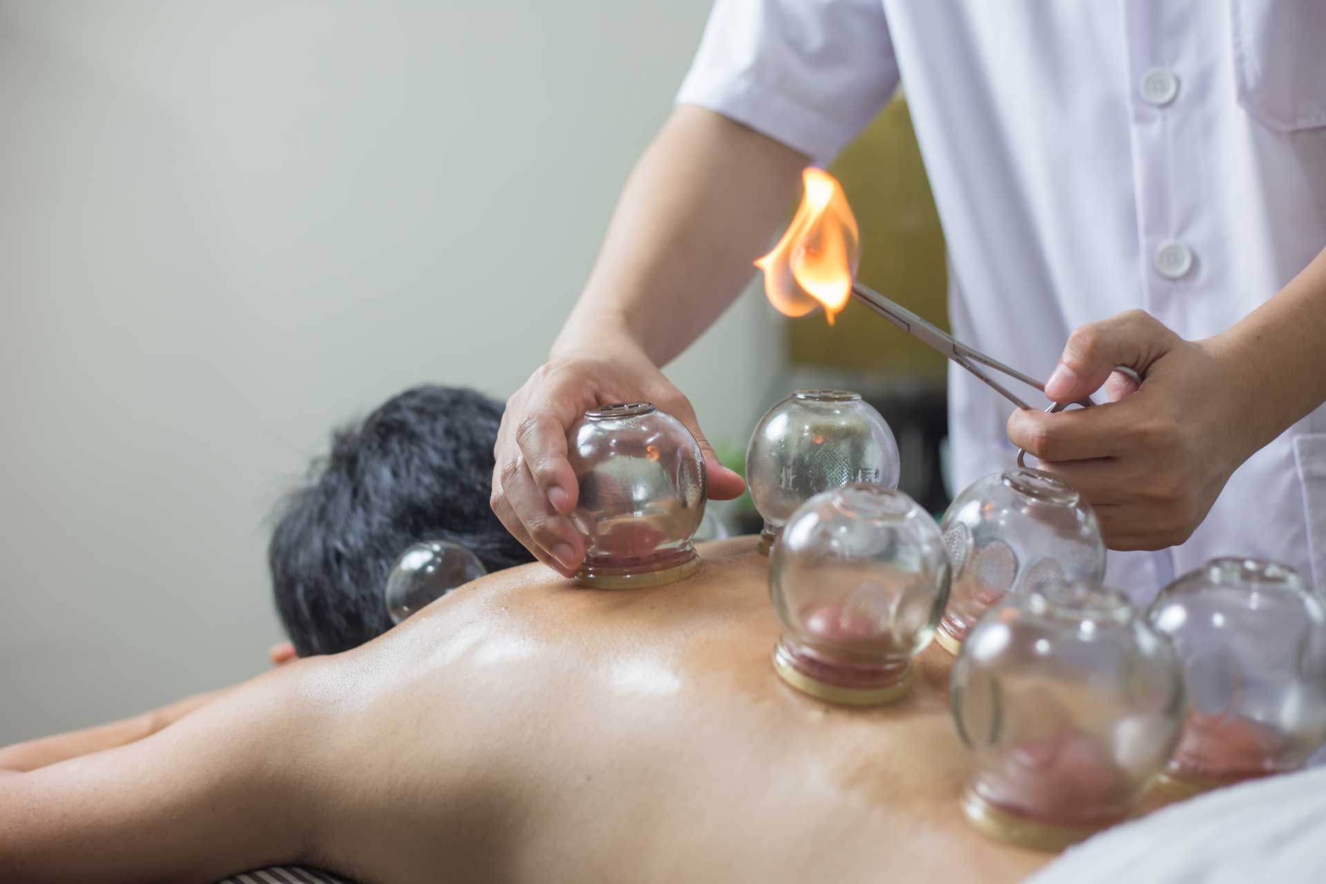 cupping therapy melbourne