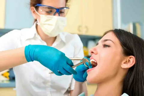 Tooth extractions Alexandria